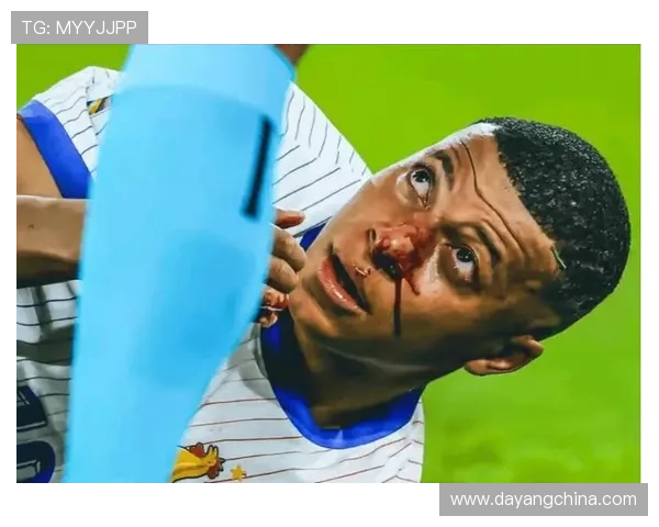 姆巴佩左膝伤情严重 接近极限需紧急治疗